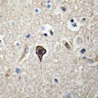 Anti-TWEAK Antibody