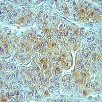Anti-RIOK3 Antibody