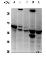 Histone Deacetylase 3 Antibody