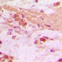 Anti-TSC22 Antibody