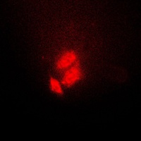 Anti-TSC22 Antibody