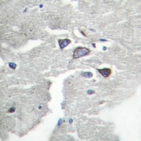 Anti-CDK5R1 p35 Antibody