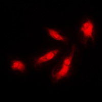 Anti-CDK5R1 p35 Antibody