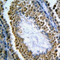 Anti-GANP Antibody