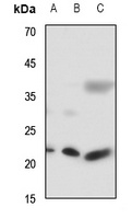 RAB7L1 Antibody