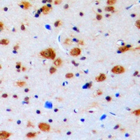Anti-Topoisomerase 3 beta1 Antibody