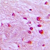 Anti-p39 Antibody