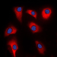 Anti-p39 Antibody