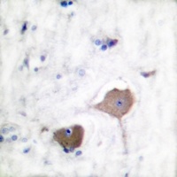 Anti-Nop30 Antibody