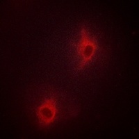 Anti-Nop30 Antibody