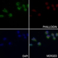 Anti-SOCS3 Antibody