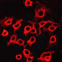 Anti-CCRL2 Antibody