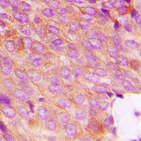 Anti-DOK2 (Phospho-Y299) Antibody