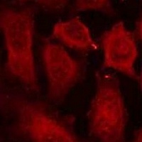 Anti-DOK2 (Phospho-Y299) Antibody