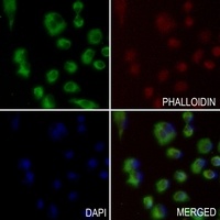 Anti-ANGPTL1 Antibody