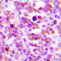 Anti-Claudin 2 Antibody
