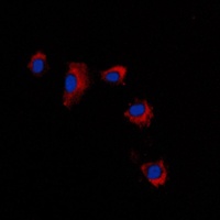 Anti-Claudin 2 Antibody