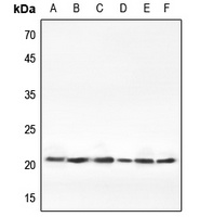 Claudin 1 Antibody