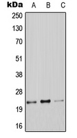 Claudin 9 Rabbit Polyclonal Antibody