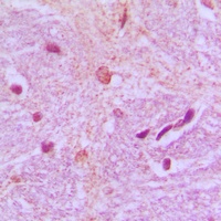 Anti-TBX15/18 Antibody