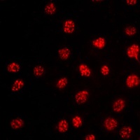 Anti-TBX15/18 Antibody