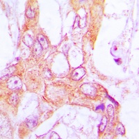 PDLIM1 antibody