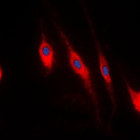 PDLIM1 antibody