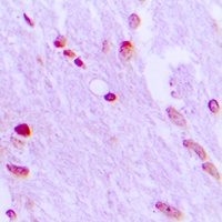Anti-AIFM1 Antibody