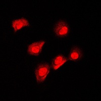 Anti-AIFM1 Antibody