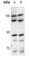 ARHGEF1 Antibody