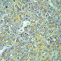 ARHGEF1 antibody