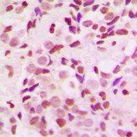Anti-NEMF Antibody