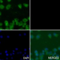 Anti-NEMF Antibody