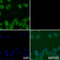 NEMF antibody