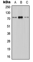 CNT1 Rabbit Polyclonal Antibody