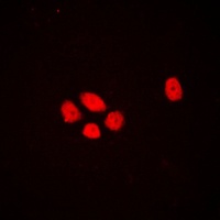Anti-EXO1 Antibody