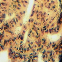 Anti-MYOM2 Antibody