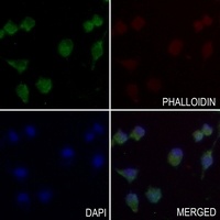 MYOM2 antibody