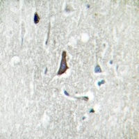 Anti-LZK Antibody