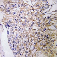 Anti-GEF H1 Antibody