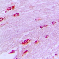 Anti-BUB3 Antibody