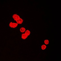 Anti-BUB3 Antibody
