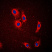 SLC24A1 antibody
