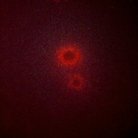 Anti-LRAT Antibody