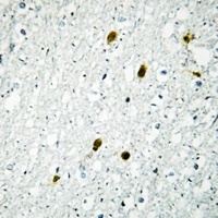 Anti-MSK1 (Phospho-T581) Antibody