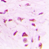 Anti-STK17B Antibody