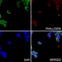 Anti-GPR52 Antibody