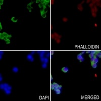 GPR52 antibody