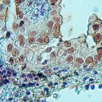Anti-SFRS11 Antibody