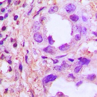 Anti-TRIP13 Antibody